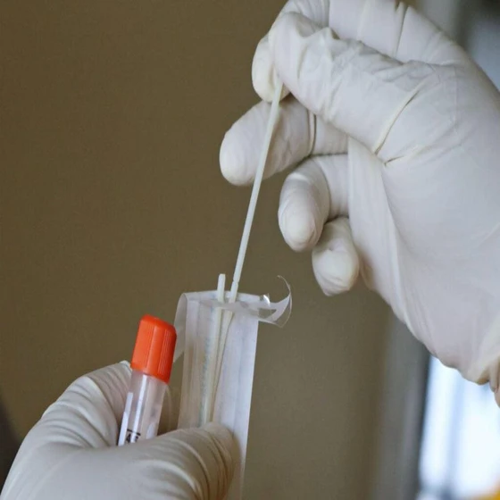 virus-testing-services-2.webp