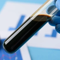 Heavy Fuel Oil