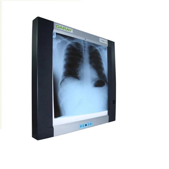 x-ray-film-viewer-2.webp