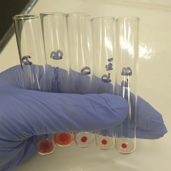 agglutination-test-tube-2.webp