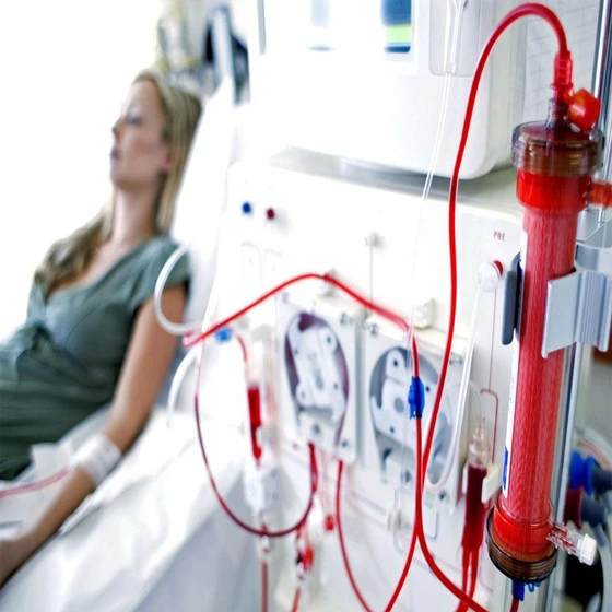 dialysis-machine-2.webp