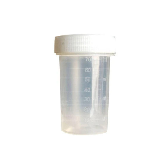 urine-culture-bottles-2.webp