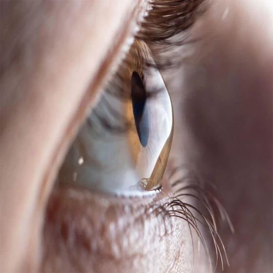 advance-contact-lenses-2.webp